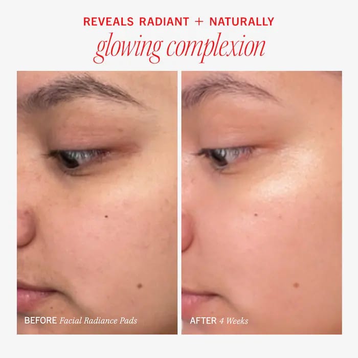 First Aid Beauty Facial Radiance Pads (60 Pads)